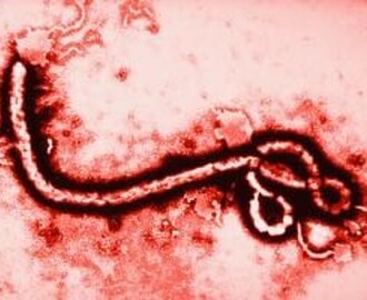 Sierra Leones chefsläkare för arbetet mot Ebola drabbas själv av viruset