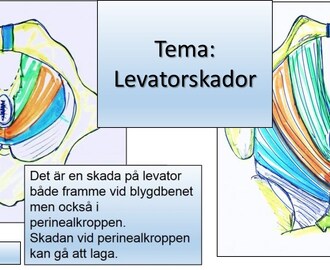 Levatorskador och risk för framfall