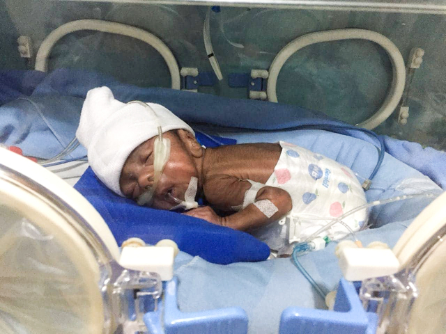 Hjälp att rädda Baby Adyatma